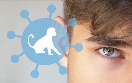 Koniec epidemii małpiej ospy w Holandii
