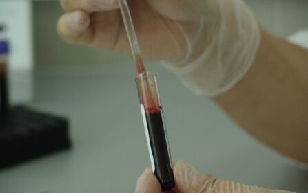 Holendrzy coraz częściej odmawiają badania krwi